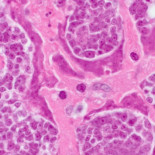 Hombre muere debido a que la tenia solitaria que vivía en su cuerpo tenía cáncer [ENG]