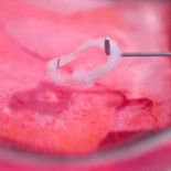 Hay esfínteres anales de repuesto