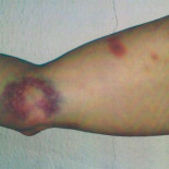 Otro incidente de los mossos [CAT]