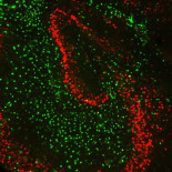 Golpe español al alzhéimer: identificadas las células 'culpables' de la pérdida de memoria