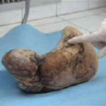 46 años embarazada [ENG]